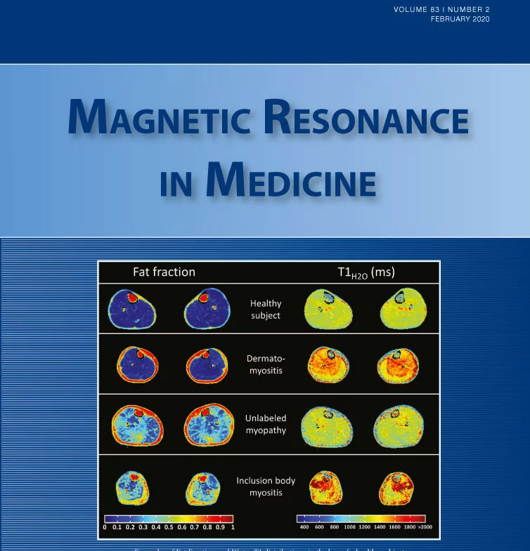 In vivo localized ESR spectroscopy reflecting metabolism